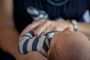 Unequal Pain: Addressing Endometriosis in Black Women’s Health